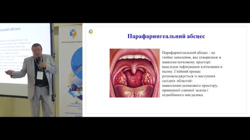 Відіотека