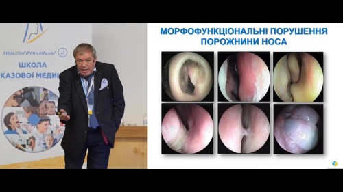 Відіотека